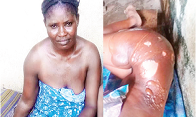 Woman pours hot water on neighbour for greeting her husband